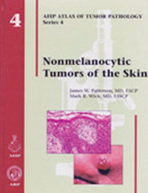 Nonmelanocytic Tumors of the Skin, Hardback Book