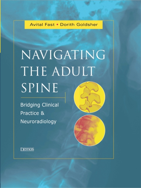 Navigating the Adult Spine : Bridging Clinical Practice and Neuroradiology, Hardback Book