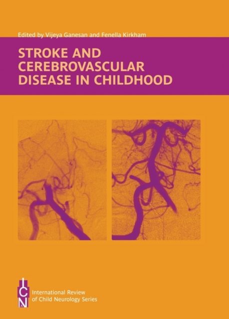 Stroke and Cerebrovascular Disease in Childhood, Hardback Book