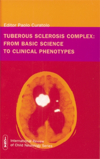 Tuberous Sclerosis Complex : From Basic Science to Clinical Phenotypes, Hardback Book