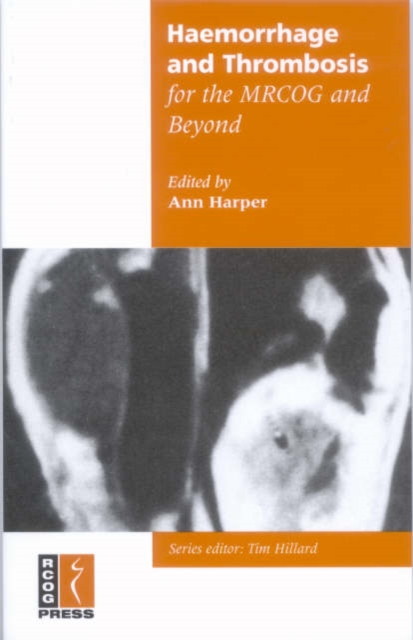 Haemorrhage and Thrombosis for the MRCOG and Beyond, Paperback / softback Book