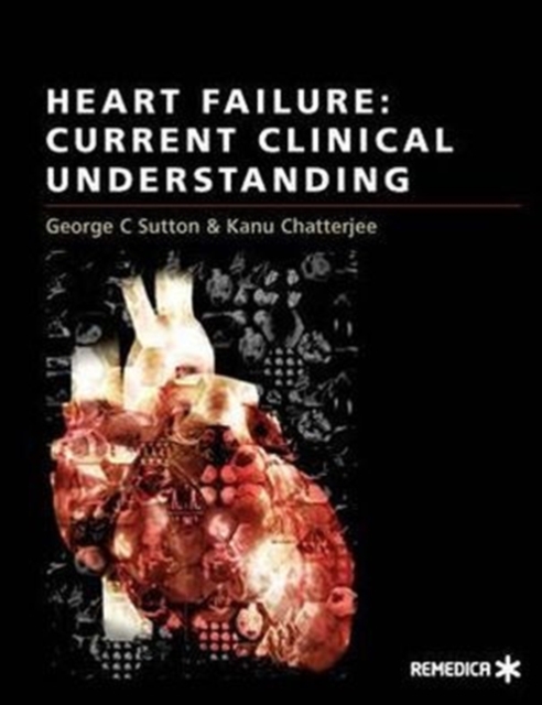 Heart Failue: Current Clinical Understanding, Paperback Book