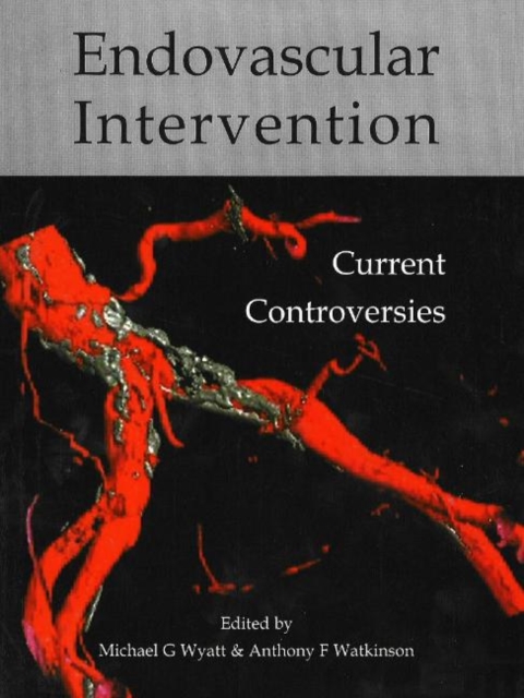 Endovascular intervention : Current controversies, Paperback / softback Book