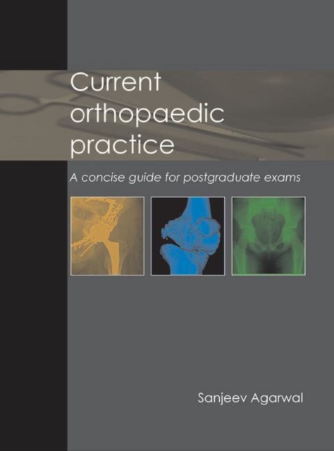 Current Orthopaedic Practice : A concise guide for postgraduate exams, Hardback Book