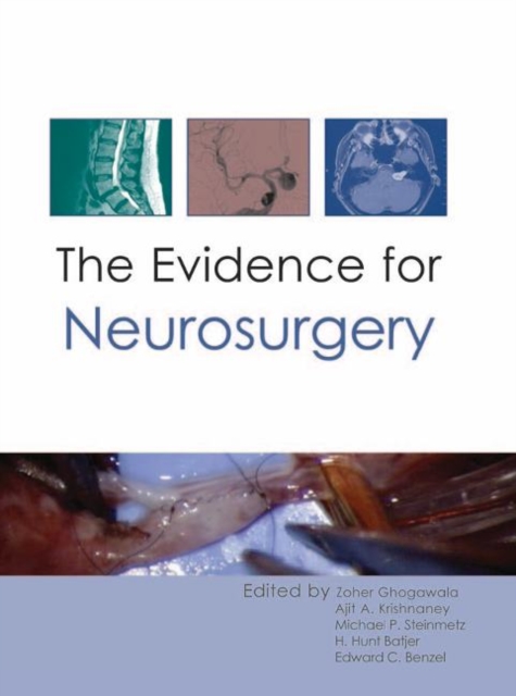 Evidence for Neurosurgery, Hardback Book