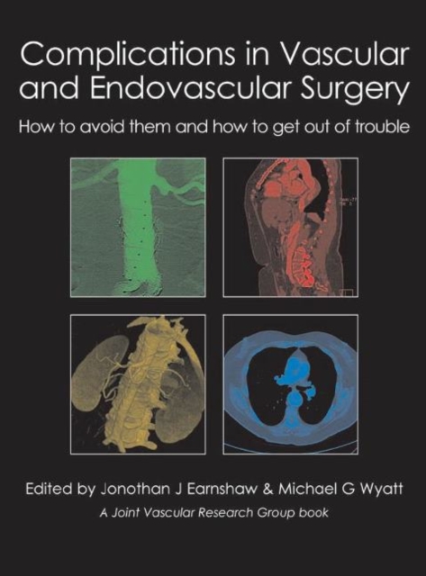 Complications in Vascular and Endovascular Surgery : How to avoid them and how to get out of trouble, Hardback Book