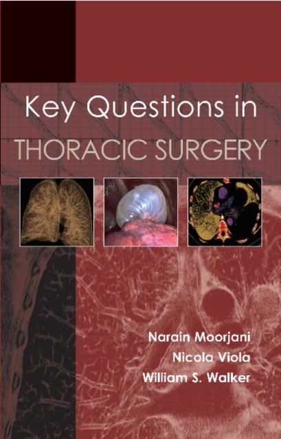 Key Questions in Thoracic Surgery, Paperback / softback Book