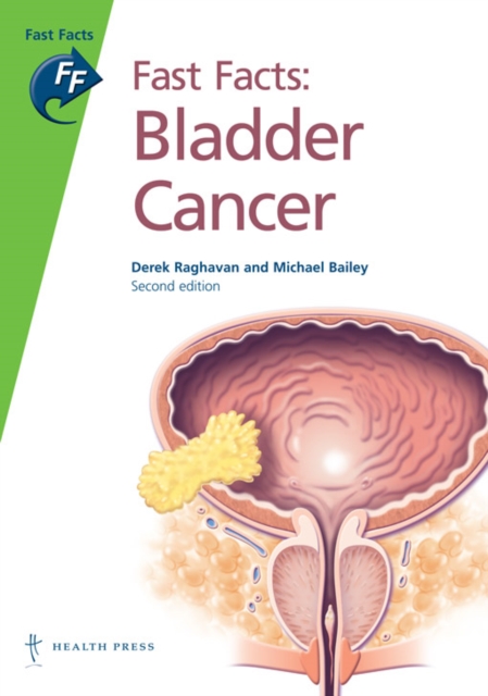 Fast Facts: Bladder Cancer, Paperback / softback Book