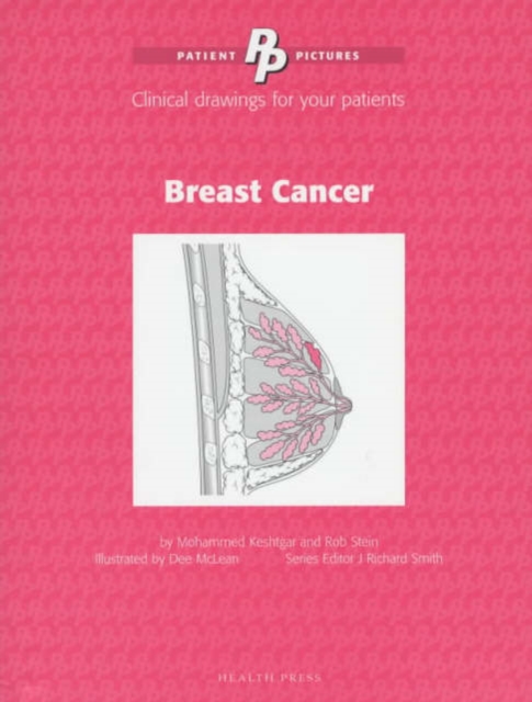 Patient Pictures: Breast Cancer : Clinical drawings for your patients Illustrated by Dee McLean., Spiral bound Book
