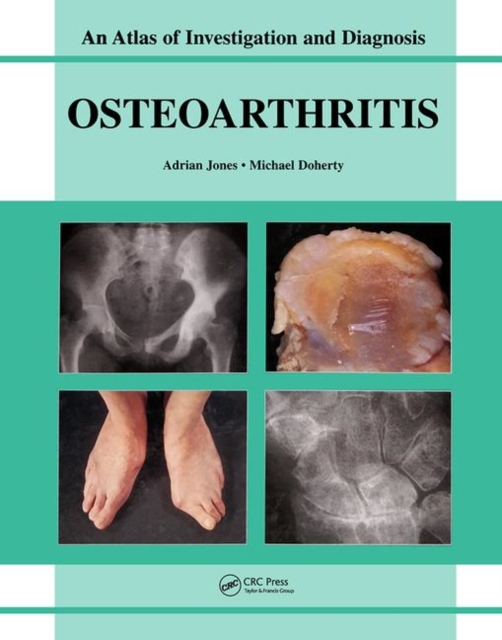 Oesteoarthritis : An Atlas of Investigation and Diagnosis, Hardback Book
