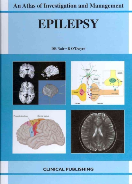 Epilepsy, Hardback Book