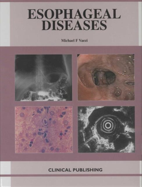 Esophageal Diseases, Hardback Book