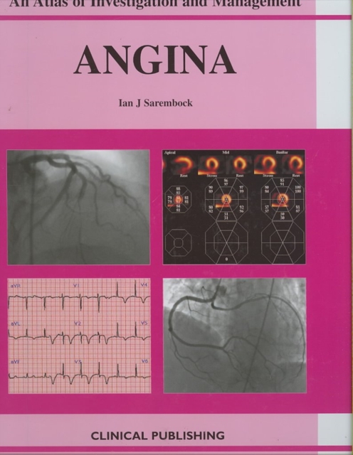 Angina, Hardback Book