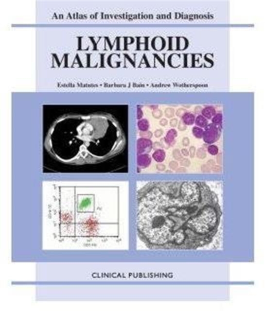 Lymphoid Malignancies : v. 1, Hardback Book