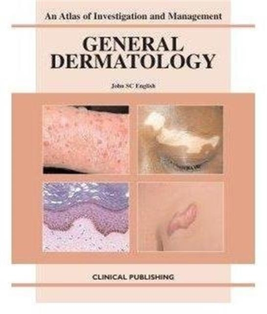General Dermatology, Hardback Book