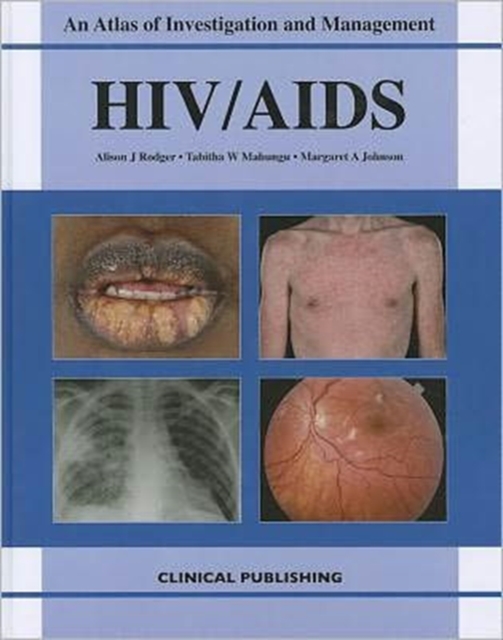 HIV/AIDS, Hardback Book