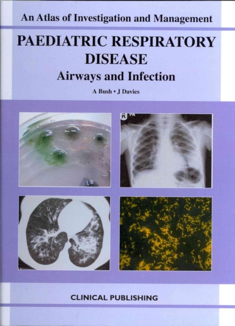 Paediatric Respiratory Disease : Airways and Infection, Hardback Book