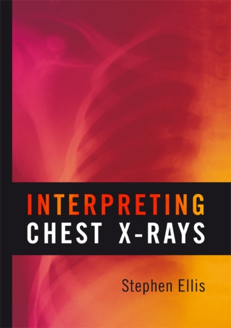Interpreting Chest X-Rays, Paperback / softback Book
