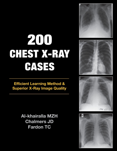 200 Chest X-Ray Cases, Paperback / softback Book