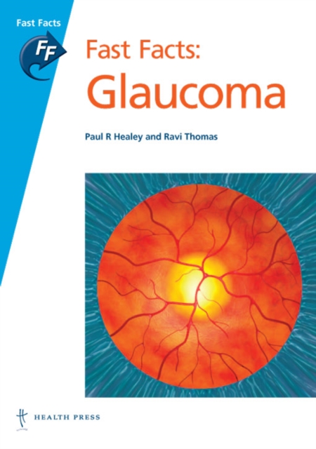Fast Facts: Glaucoma, Paperback / softback Book