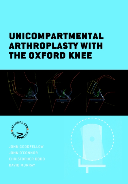 Unicompartmental Arthroplasty with the Oxford Knee, Hardback Book