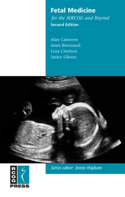 Fetal Medicine for the MRCOG and Beyond, Paperback / softback Book