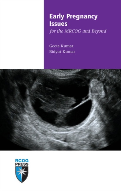 Early Pregnancy Issues for the MRCOG and Beyond, Paperback / softback Book