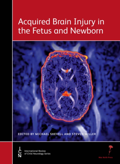 Acquired Brain Injury in the Fetus and Newborn, Hardback Book