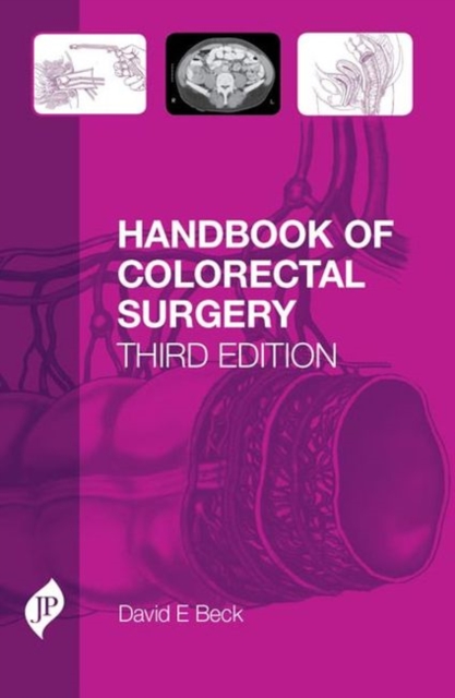 Handbook of Colorectal Surgery : Third Edition, Hardback Book