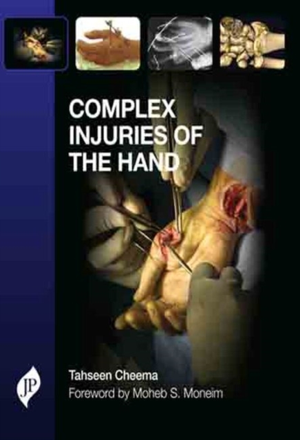 Complex Injuries of the Hand, Hardback Book