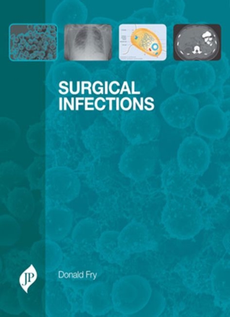 Surgical Infections, Hardback Book