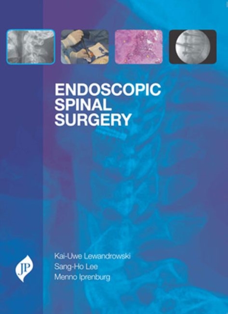 Endoscopic Spinal Surgery, Hardback Book