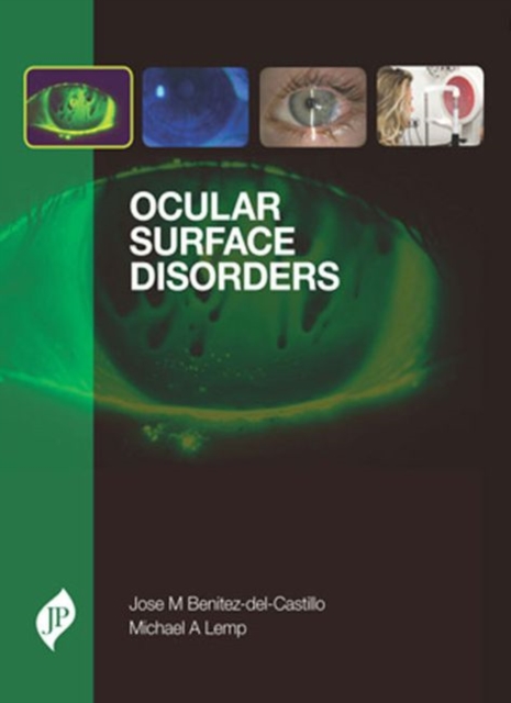 Ocular Surface Disorders, Hardback Book