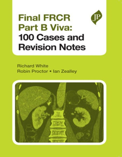 Final FRCR Part B Viva: 100 Cases and Revision Notes, Paperback / softback Book