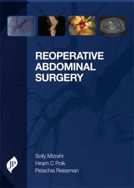 Reoperative Abdominal Surgery, Hardback Book