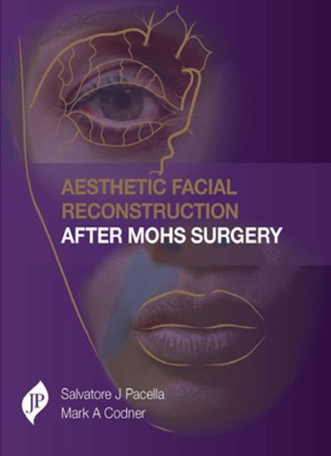 Aesthetic Facial Reconstruction After Mohs Surgery, Hardback Book