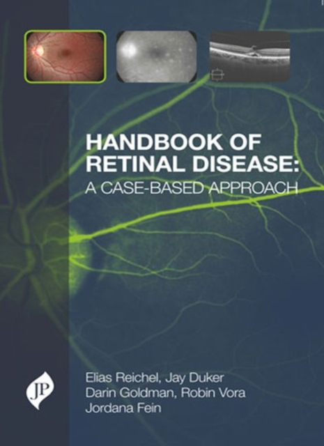 Handbook of Retinal Disease: a Case-based Approach, Hardback Book