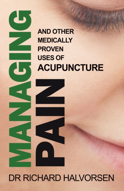 Managing Pain : And Other Medically Proven Uses of Acupuncture, Paperback / softback Book