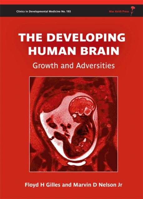 The Developing Human Brain : Growth and Adversities, Hardback Book
