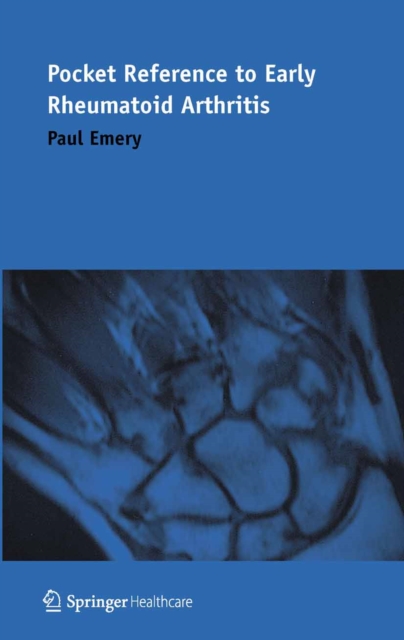 Pocket Reference to Early Rheumatoid Arthritis, PDF eBook