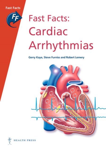 Fast Facts: Cardiac Arrhythmias : Now available: 3rd edition: Fast Facts: Cardiac Arrhythmias, Paperback / softback Book