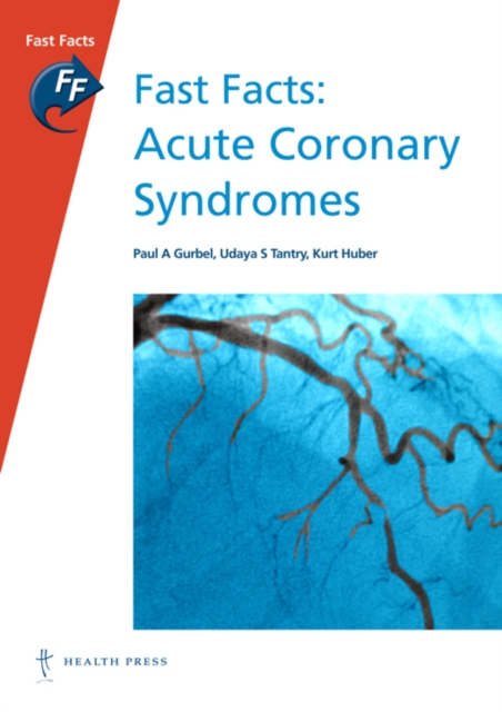 Fast Facts: Acute Coronary Syndromes, Paperback / softback Book