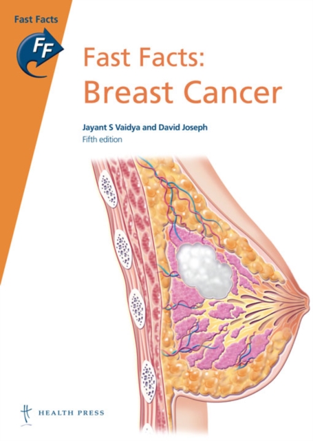 Fast Facts: Breast Cancer, Paperback / softback Book