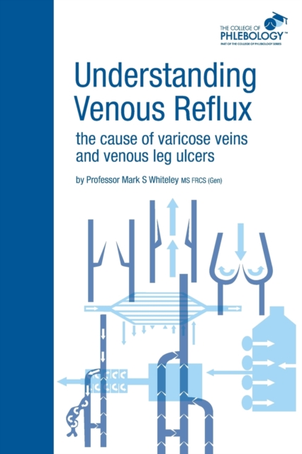 Understanding Venous Reflux the Cause of Varicose Veins and Venous Leg Ulcers, Paperback / softback Book