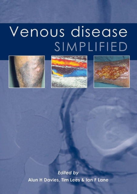 Venous Disease Simplified, PDF eBook