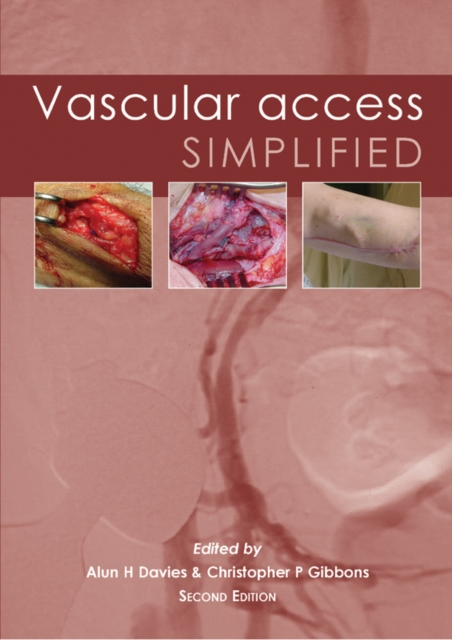 Vascular Access Simplified; second edition, EPUB eBook