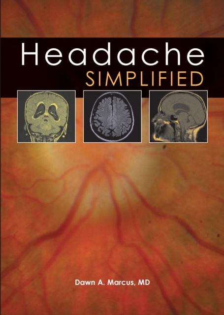 Headache Simplified, PDF eBook