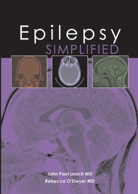 Epilepsy Simplified, PDF eBook