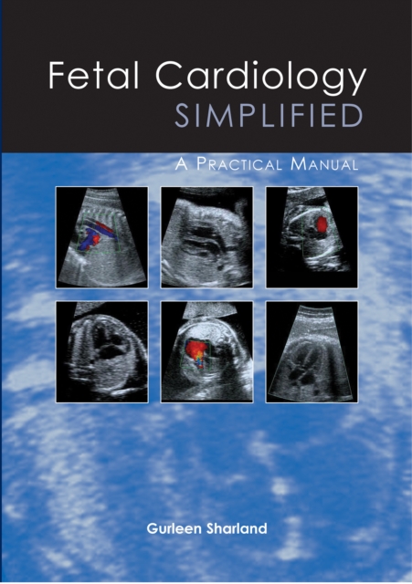 Fetal Cardiology Simplified, EPUB eBook