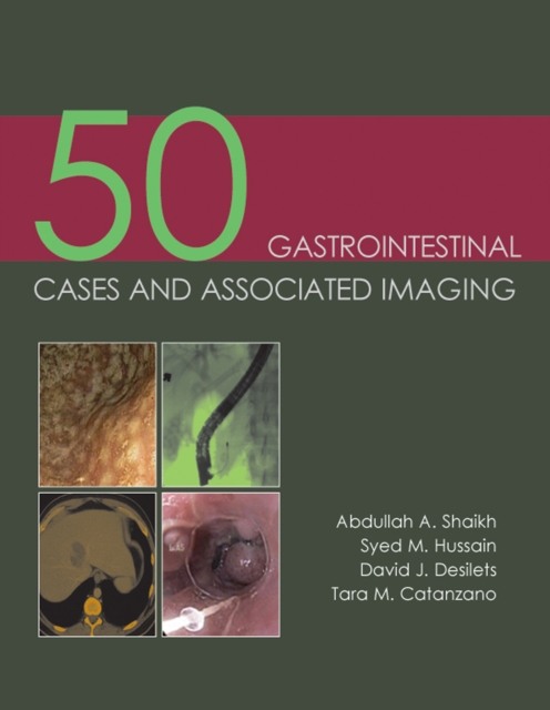 50 Gastrointestinal Cases and Associated Imaging, EPUB eBook